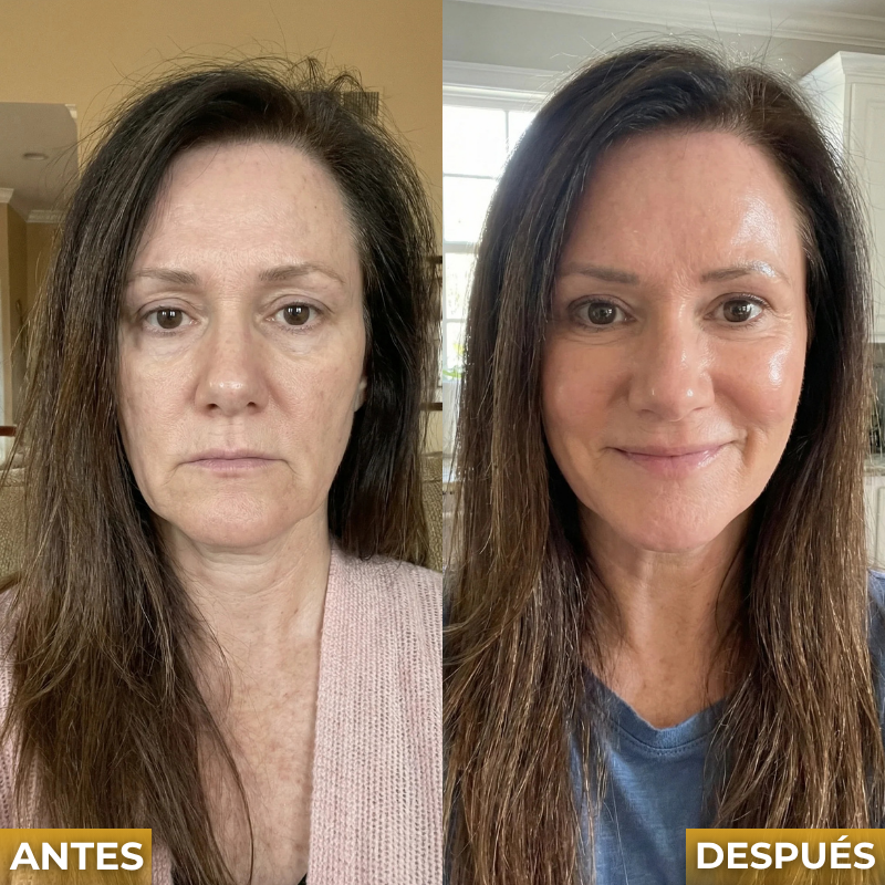 Veltrix™ Sérum Facial Intensivo Antiarrugas